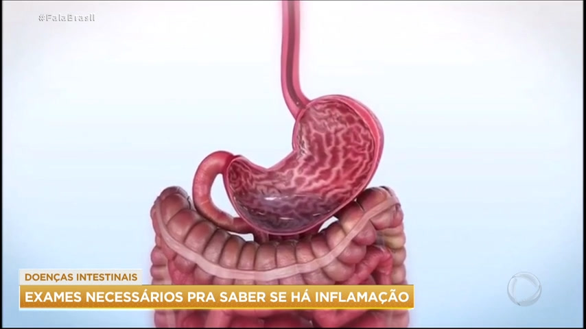 You are currently viewing Maio roxo: Conheça as doenças inflamatórias intestinais