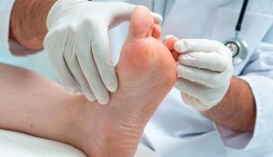 Read more about the article Diabetes pode ser identificada pela aparência dos pés