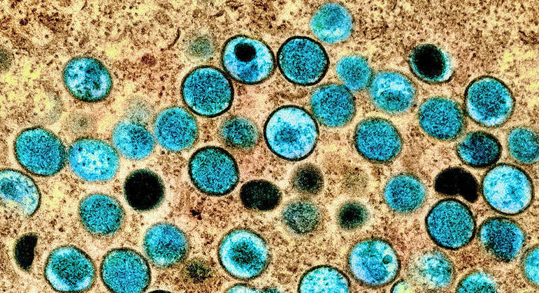 You are currently viewing Rússia confirma o primeiro caso de varíola do macaco