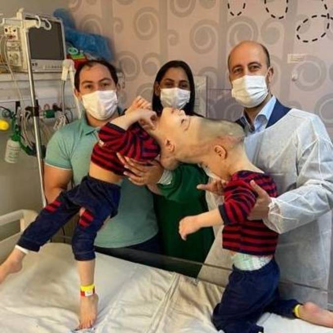 You are currently viewing Após cirurgia de 27 horas, médicos brasileiros separam gêmeos siameses unidos pela cabeça