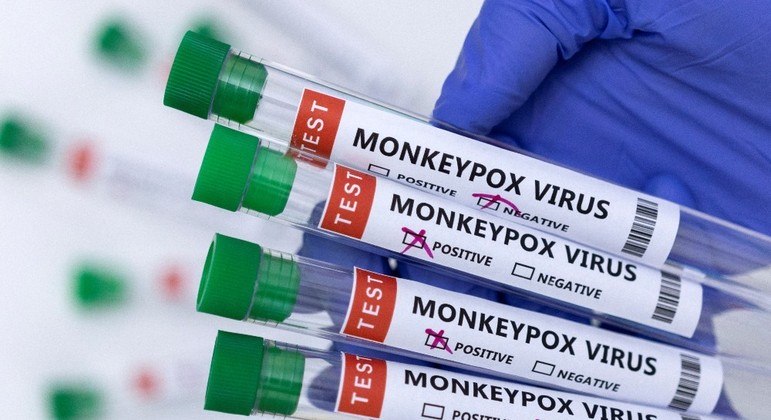 You are currently viewing Número de casos de varíola do macaco sobe quase 50% em uma semana no Brasil e chega a 1.860