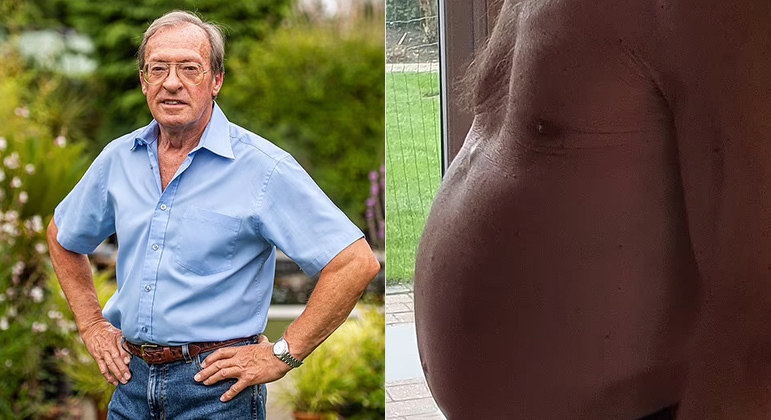 You are currently viewing Homem de 71 anos sobrevive após retirar câncer do tamanho de uma melancia e que pesava 10 kg