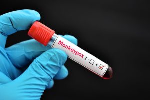 Read more about the article Varíola dos Macacos: como é o DNA do Monkeypox?