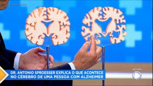 Read more about the article Você e o Doutor: Especialista esclarece dúvidas sobre o Alzheimer, que afeta 1 milhão de brasileiros
