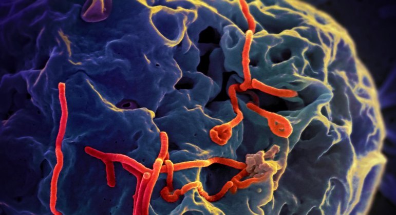 You are currently viewing Número de mortos por ebola sobe de 1 para 4 em menos de 24 horas em Uganda