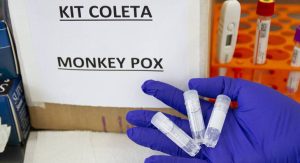 Read more about the article Laboratórios públicos de todas as capitais brasileiras já podem fazer teste de varíola do macaco