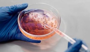Read more about the article Crise na pesquisa de antibióticos pode prejudicar combate a superbactérias