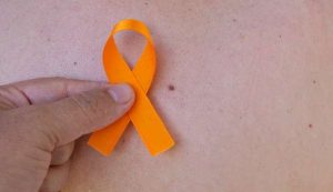 Read more about the article Remoção do câncer de pele exige cirurgia plástica para reparação da região
