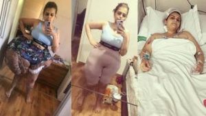 Read more about the article Médicos brasileiros retiram quase 35 kg de tumor de mulher com doença rara: ‘Salvou a vida dela’