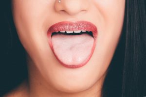 Read more about the article A cor da sua língua pode dizer muito sobre sua saúde