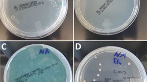 Read more about the article Pandemia pode ter ajudado a triplicar casos de infecção por fungo perigoso nos EUA