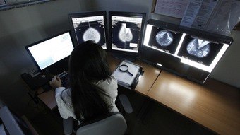 You are currently viewing Inteligência artificial detecta câncer de mama com precisão semelhante à de médicos