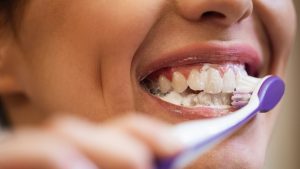 Read more about the article Higiene Bucal: qual a importância de manter a saúde da boca em dia?