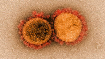 You are currently viewing Eris: nova variante do coronavírus é perigosa? Entenda riscos no Brasil e no mundo